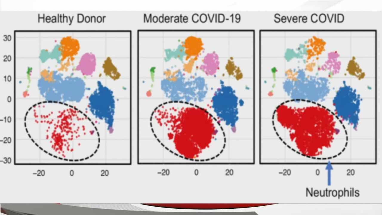 U of L COVID-19 Research Graphic